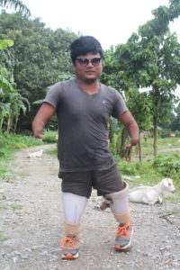 A man wearing sunglasses walks with two prosthetic legs and two arms that end in stumps at his forearm. His home is behind him, with banana trees and two goats laying on the ground behind him in the distance.